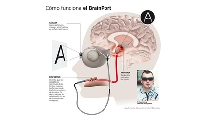 brain,brainco